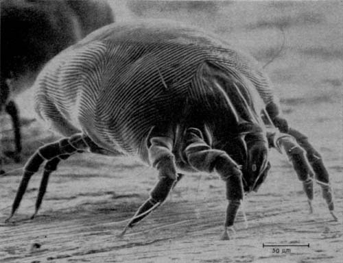 L'image montre à quoi ressemble un acarien de la poussière de maison fortement agrandi. On peut voir que ces arachnides ont un corps ovale et disposent de quatre paires de pattes, soit huit pattes fines.